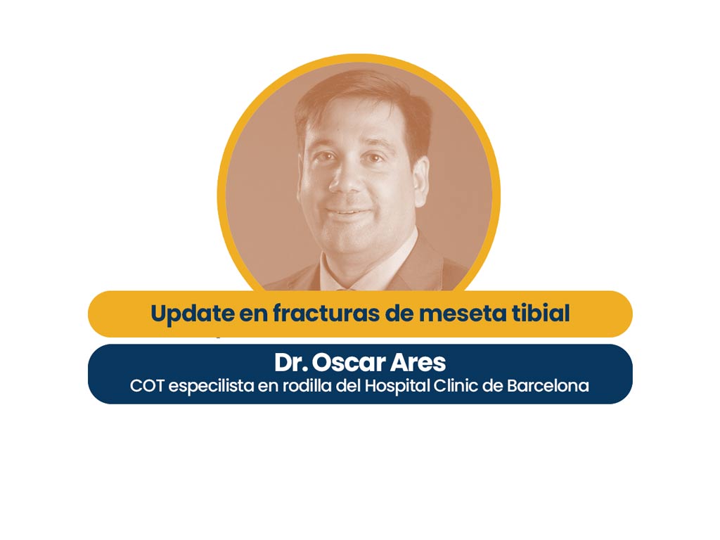 hero image oscar ares